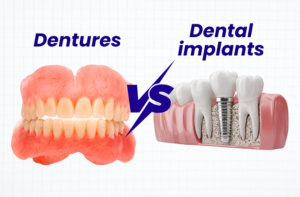 Dental Implants vs Dentures: Which Option Is Right for You?