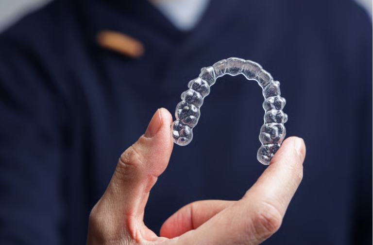 Benefits of Choosing Clear Aligners for Orthodontic Treatment
